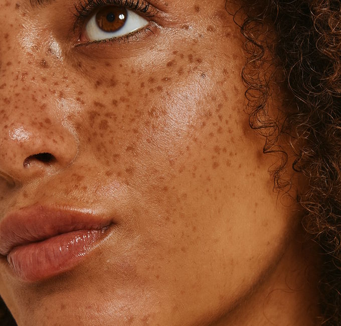 person, skin, head, face, adult, female, woman